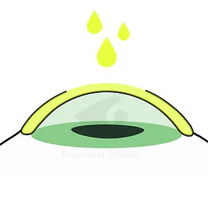 Crosslinking-Operation – Dr. Seiller-Tarbuk Wien