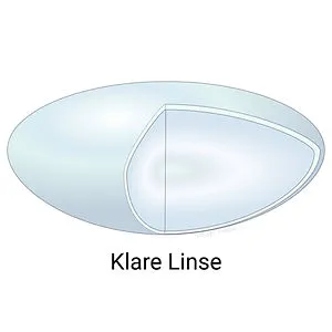 Gesundes Auge mit klarer Linse