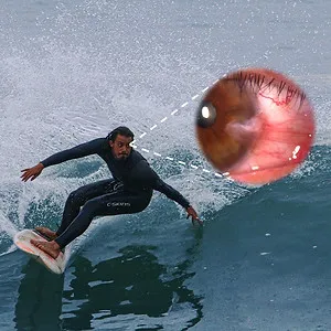 Pterygium Surfers Eye