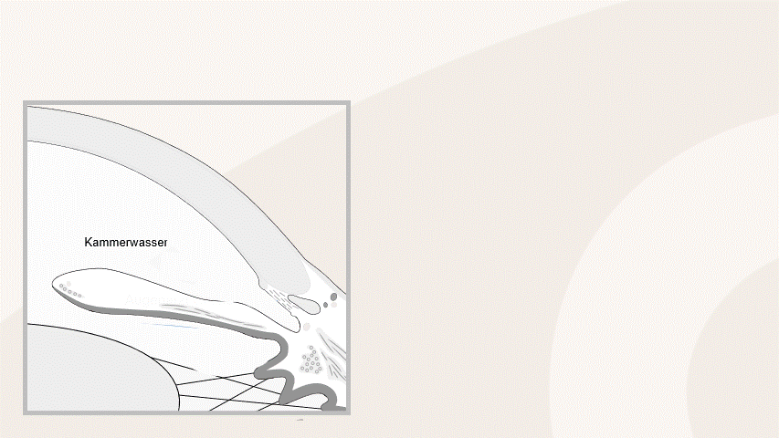 SLT Laser – Erklärung Animation